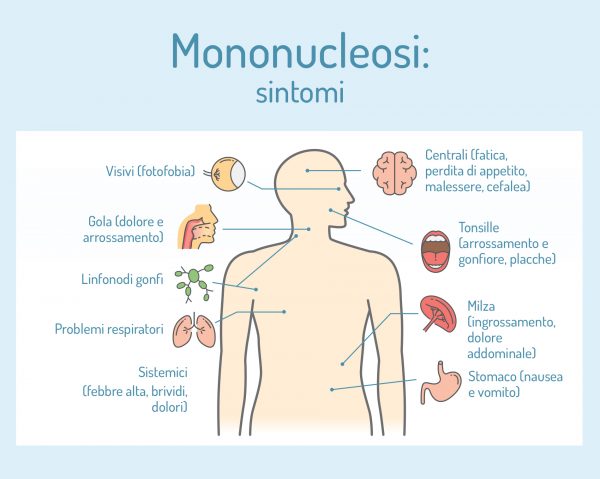 Mononucleosi cos è cause sintomi trattamento e prevenzione