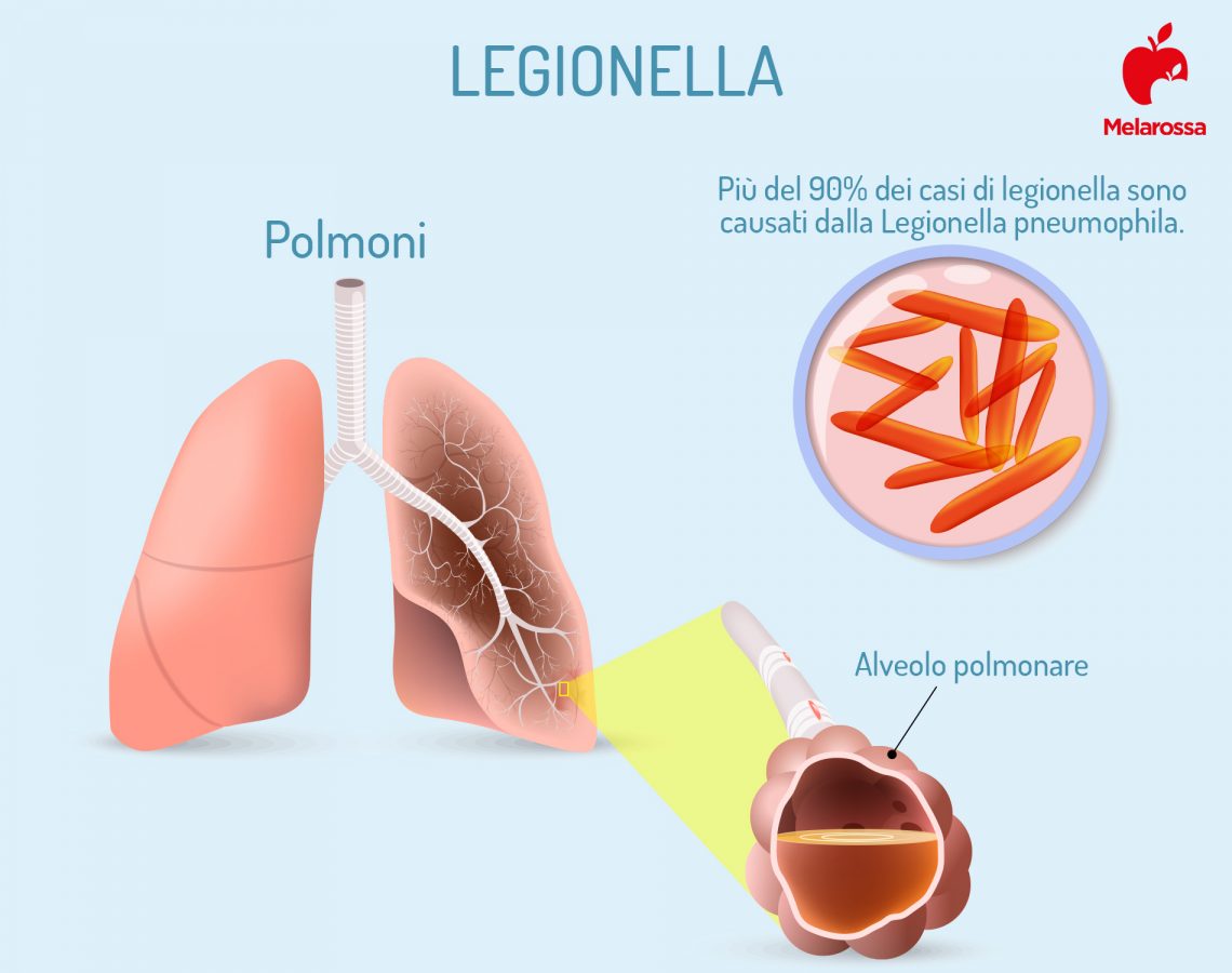 Legionella Cos Caratteristiche Contagio Sintomi Cure E Prevenzione