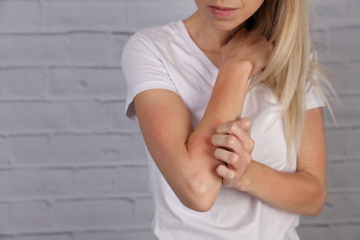 Dermatite Da Stress Cos Cause Sintomi Rimedi E Cura Prevenzione