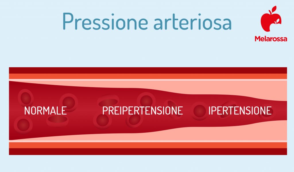 Pressione arteriosa cosè valori come si misura e trattamenti