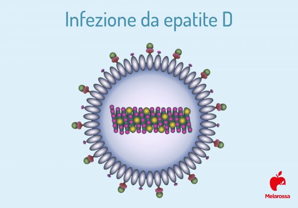 Epatite D cosè sintomi cause diagnosi cure e prevenzione