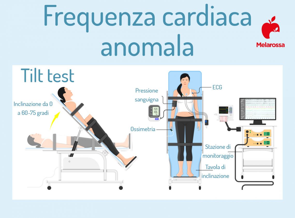 Frequenza cardiaca come si misura e cosa fare quando è bassa o alta