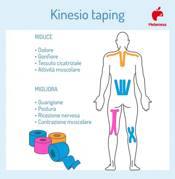 Kinesio Taping Che Cos A Cosa Serve Come Si Usa Benefici