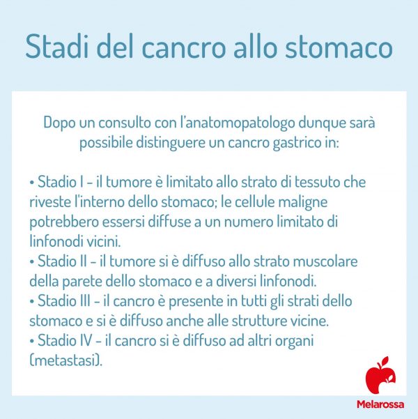 Tumore allo stomaco che cos è cause sintomi diagnosi cure