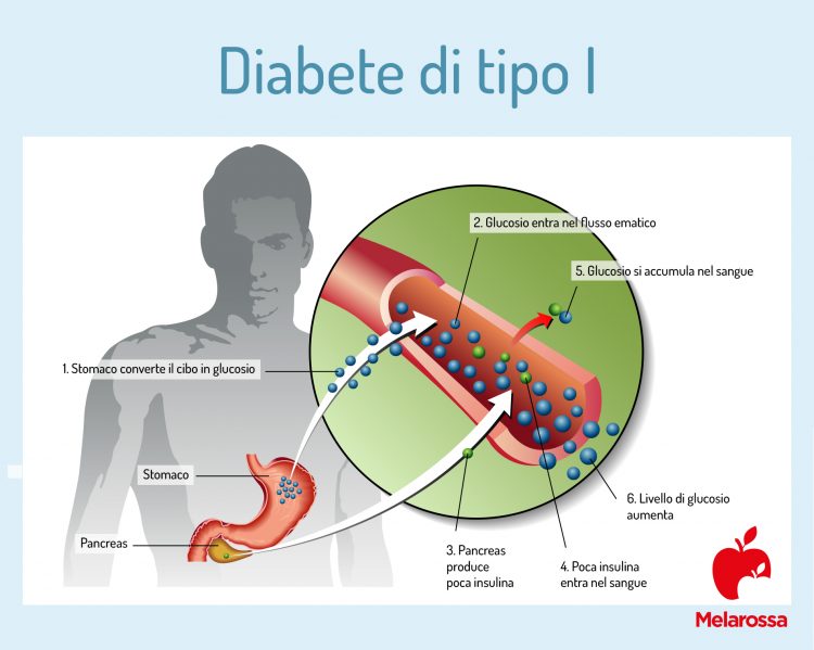 Diabete: Cos'è, Tipologie, Sintomi E Come Si Cura - Melarossa