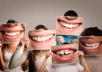 Denti: se sono in salute, meno rischi per la salute del cuore