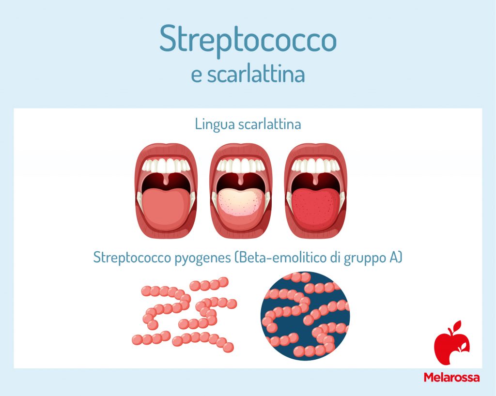 Streptococco: Cos'è, Tipi, Diagnosi, Complicazioni E Cura