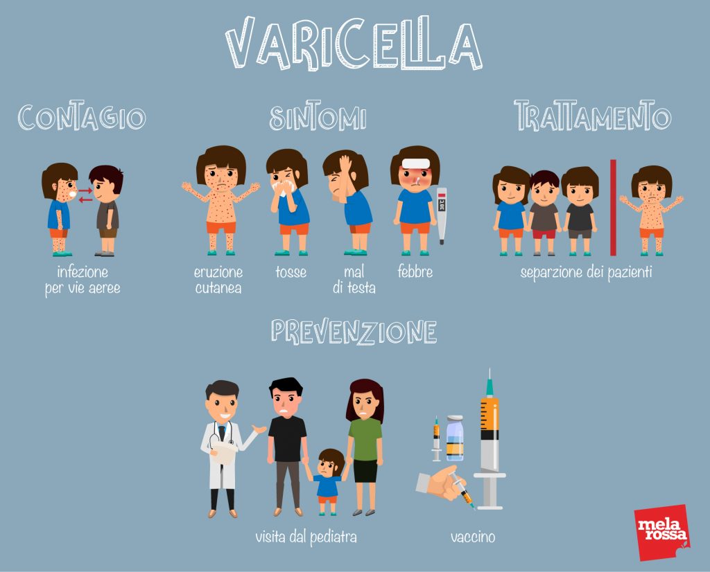 Varicella: Contagio, Sintomi, Complicazioni, Trattamenti E Prevenzione