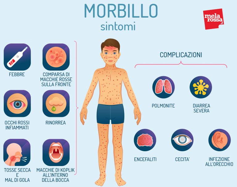 Malattie Esantematiche: Cosa Sono, Quali Sono E Come Differenziarle