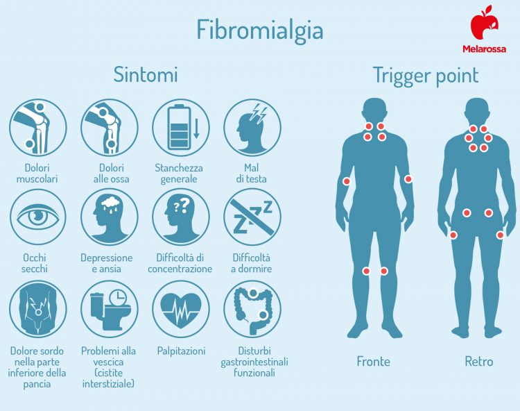 Fibromialgia cos’è, sintomi, cause, diagnosi, cure e prevenzione