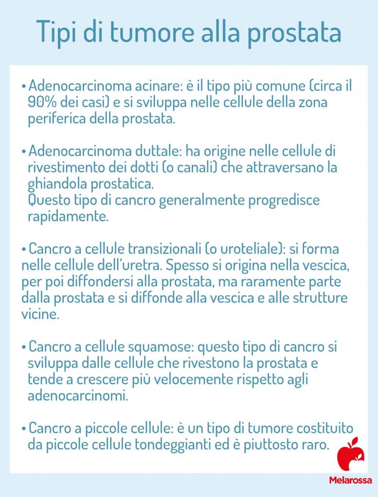 Tumore Alla Prostata: Cos’è, Sintomi, Cause, Cure E Trattamenti