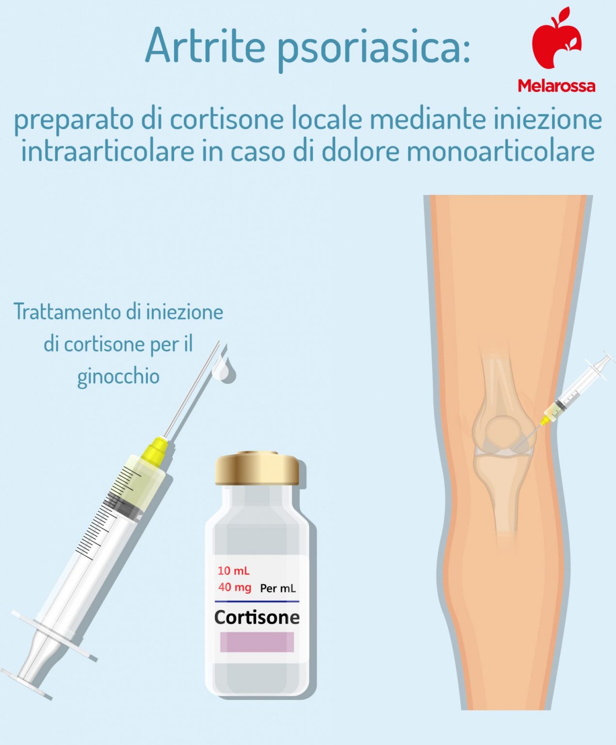 Artrite psoriasica cos’è, cause, sintomi, diagnosi e cure Melarossa