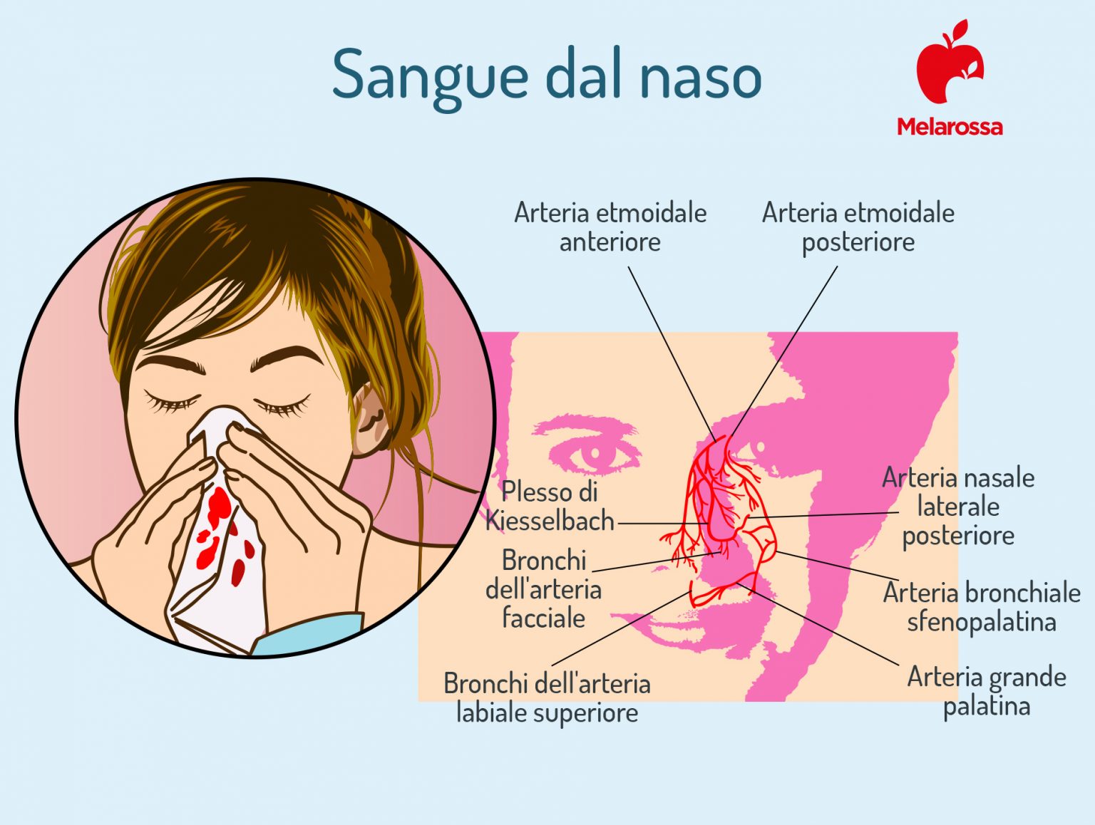 Sangue dal naso o epistassi: che cos’è, cause, sintomi, cure e trattamenti