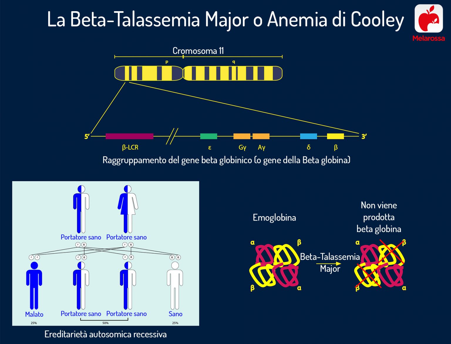 Anemia Mediterranea Cos Cause Sintomi Diagnosi Cure   Anemia Mediterranea Beta Talassemia 1536x1171 