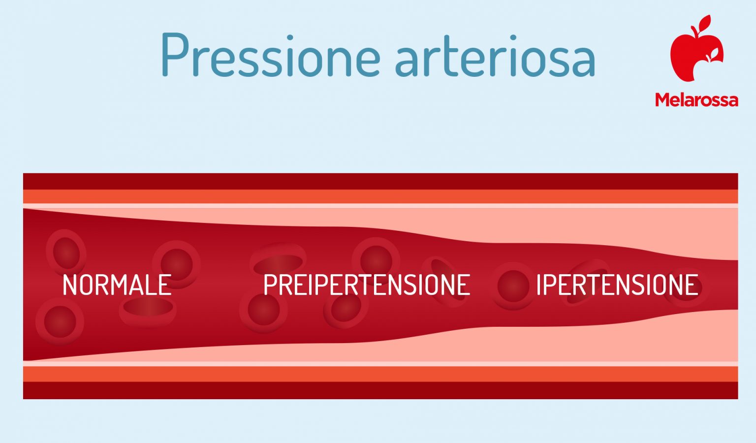 Pressione Arteriosa: Cos’è, Valori, Come Si Misura E Trattamenti