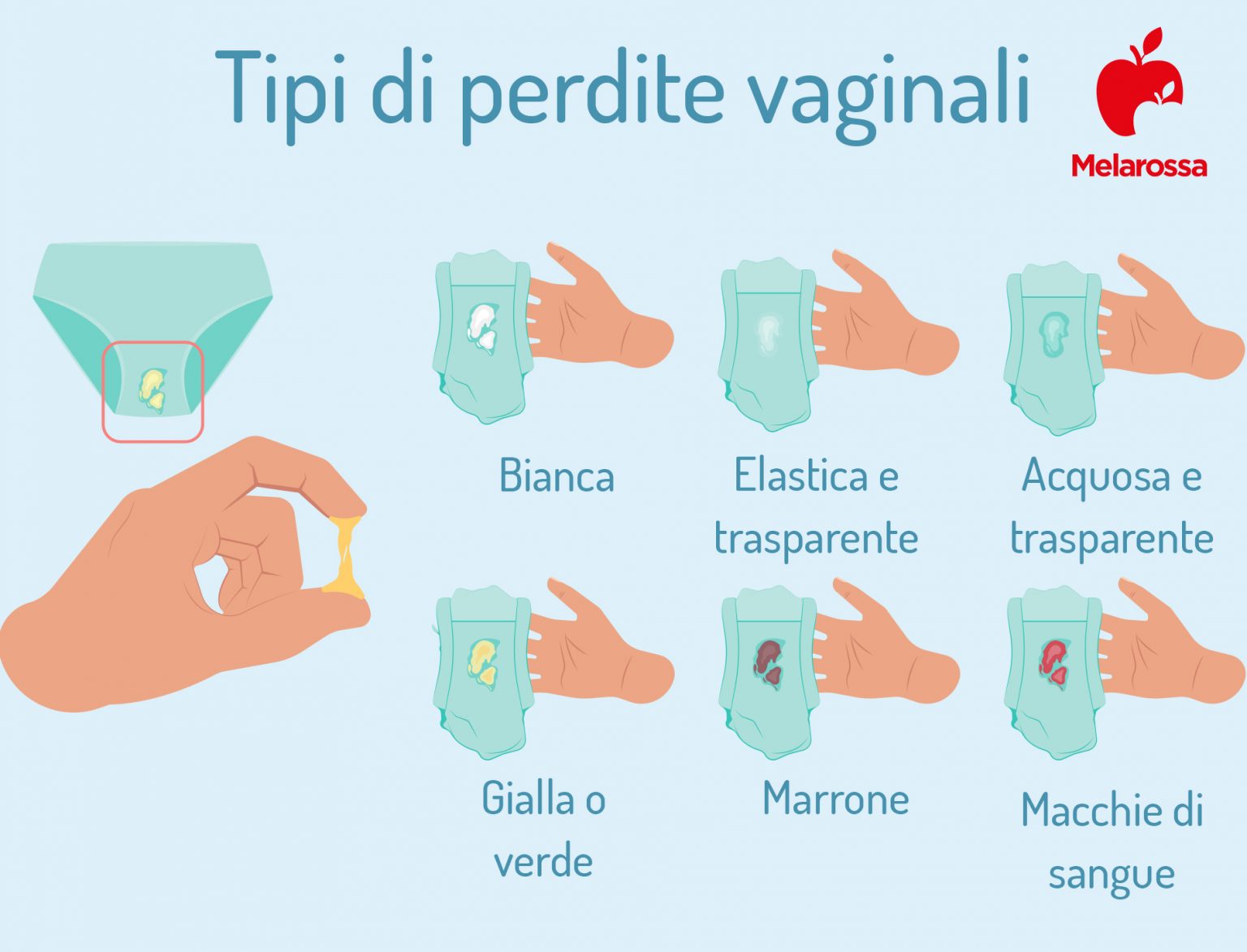 Vaginite Cosè Tipi Cause Sintomi E Trattamenti Melarossa 5947