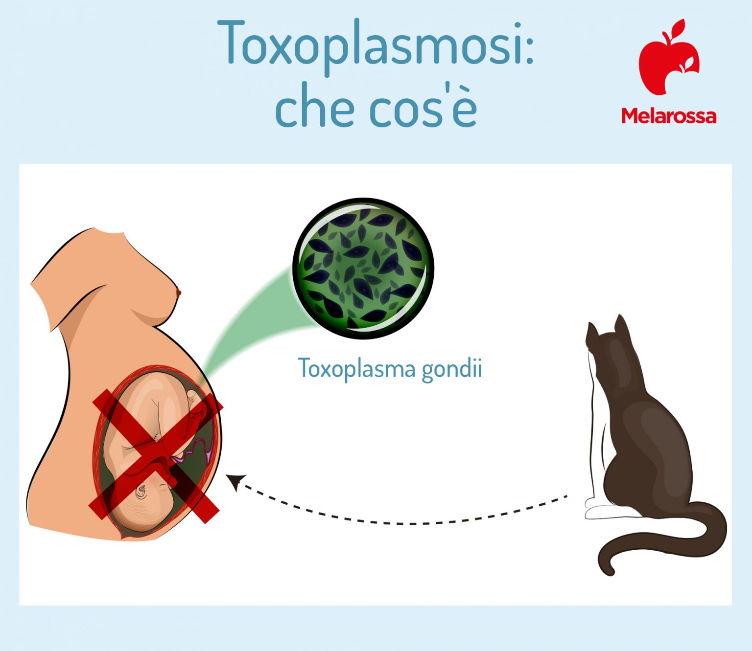 Toxoplasmosi Cosè Trasmissione Cause Sintomi Cure E Prevenzione 7455