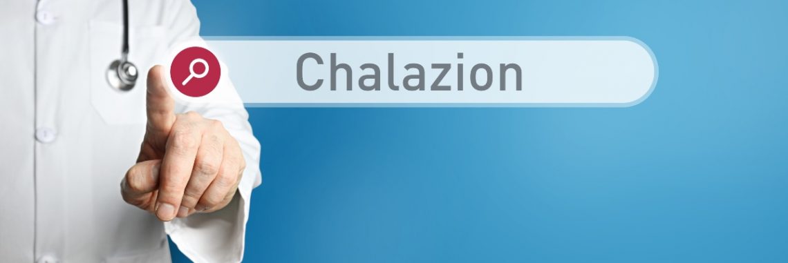 Calazio Cosè Cause Sintomi Diagnosi Come Si Cura Rimedi Naturali