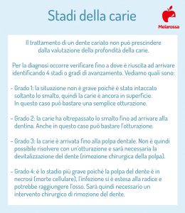 Carie Dentale: Cos'è, Sintomi, Cause, Diagnosi E Cure, Prevenzione