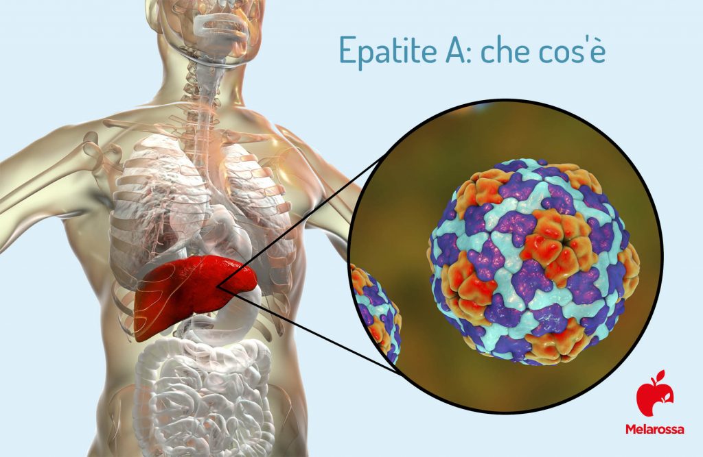 Epatite A: Che Cos’è, Sintomi, Cause, Cura E Come Si Trasmette