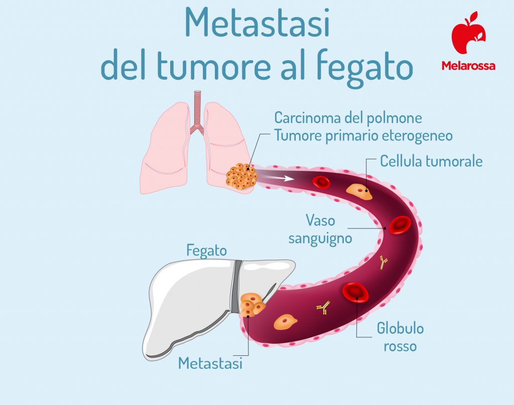 Fegato: Dove Si Trova, Quando Non Funziona Bene E Come Depurarlo