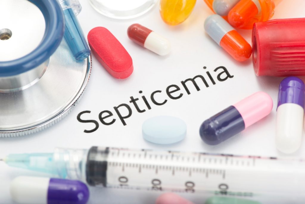 Setticemia: cos'è, cause e cura