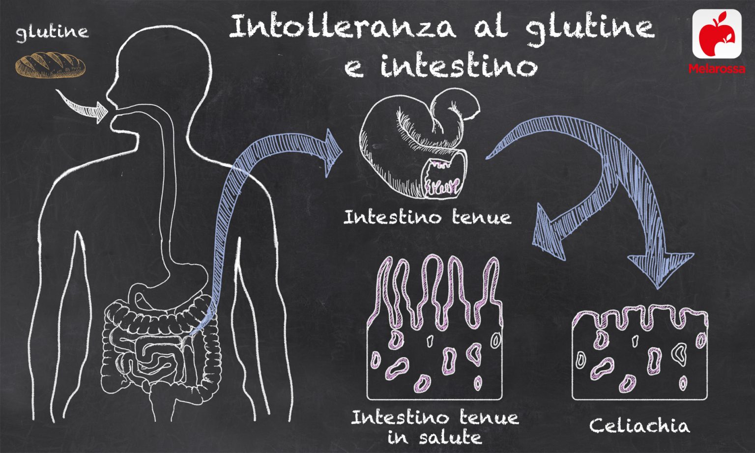 Dieta Senza Glutine: L'alimentazione Giusta Ed Esempio Di Menù - Melarossa