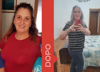 donna prima e dopo una dieta dimagrante