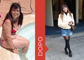 Donna prima e dopo la dieta Melarossa