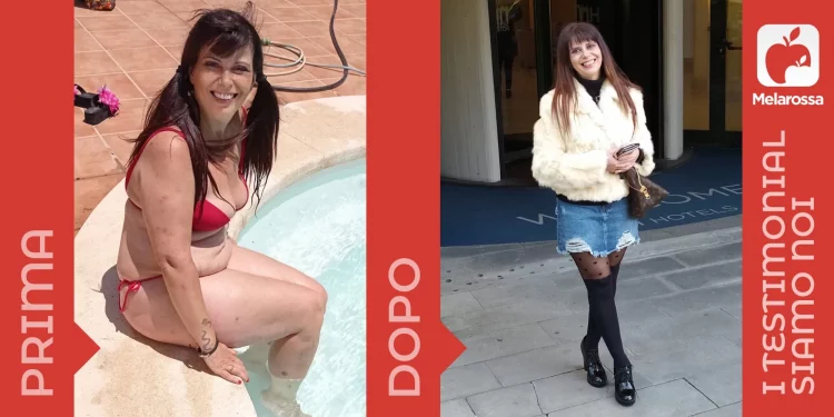 Donna prima e dopo la dieta Melarossa