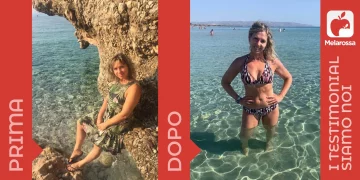 donna prima e dopo la dieta Melarossa