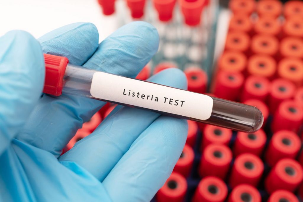 Una mano con guanti da laboratorio tiene una provetta con scritto listeria test