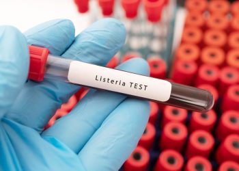 Una mano con guanti da laboratorio tiene una provetta con scritto listeria test