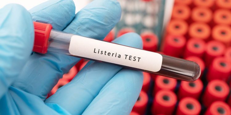 Una mano con guanti da laboratorio tiene una provetta con scritto listeria test