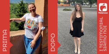 donna prima e dopo la dieta Melarossa