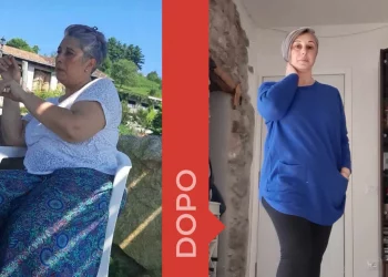 donna prima e dopo la dieta Melarossa