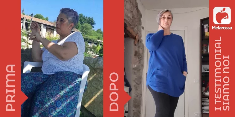 donna prima e dopo la dieta Melarossa